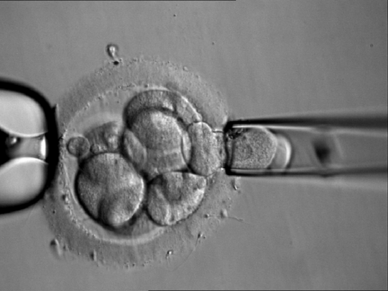 Onde Encontrar Ginecologista Especialista em Fertilidade Alto da Lapa - Centro de Reprodução Humana Onde Encontrar Ginecologista Especialista em Fertilidade Alto da Lapa - Centro de Reprodução Humana