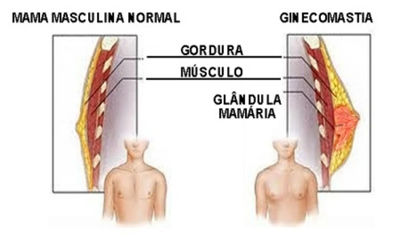 médico de mama feminina